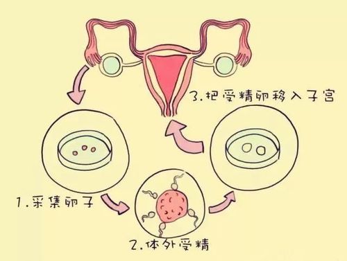 试管婴儿技术能否实现性别选择？深入探讨其伦理和法律问题