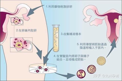 试管婴儿过程中卵泡是否能够自然生长？解析重要性与影响因素