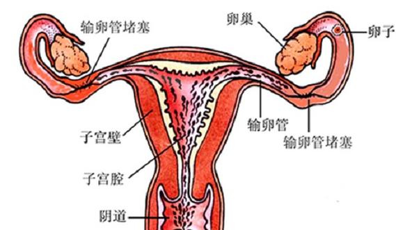 单侧输卵管