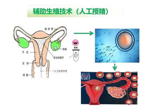  生殖技术