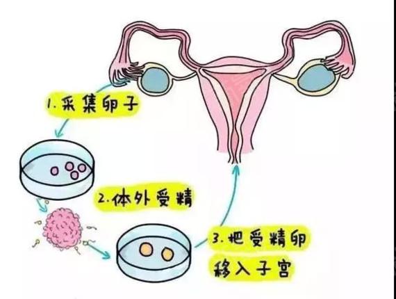 试管婴儿、生殖技术、抖音长尾词