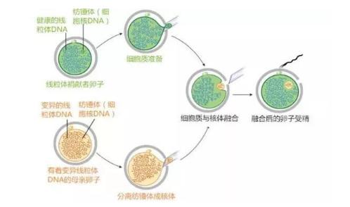 试管婴儿四代技术