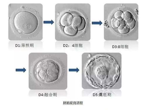 试管婴儿胚胎质量究竟是否更优越？深度解析