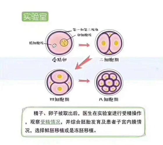 试管婴儿失败是否意味着流产？深入解析与说明