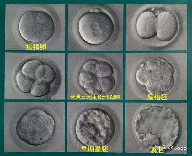 试管婴儿技术中的囊胚配对：能否实现双胞胎梦想？