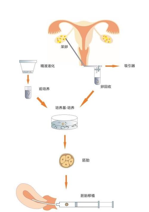 胚胎移植与试管婴儿的关系详解：你了解吗？