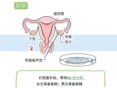 女性在进行三代试管婴儿过程中会感到疼痛吗？