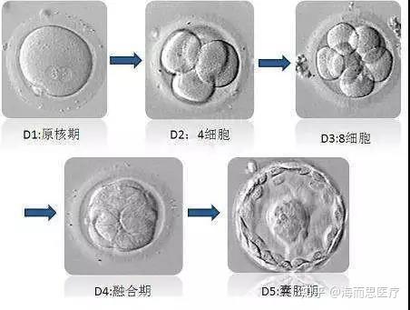 试管婴儿、胚胎移植、生殖医学