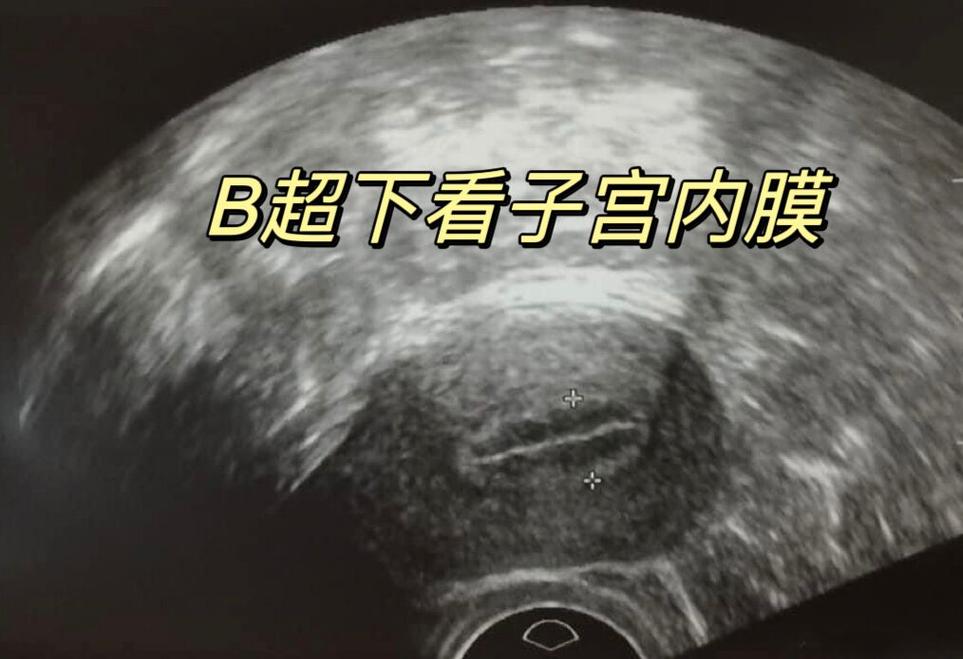 内膜厚度增加是否影响试管婴儿成功率？