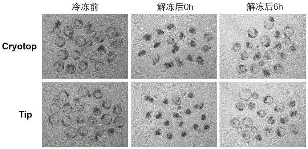 冻囊胚技术