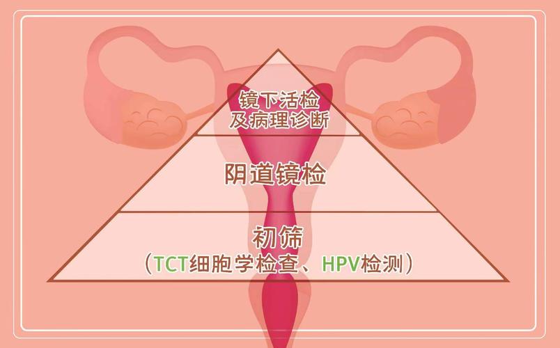 宫颈癌筛查