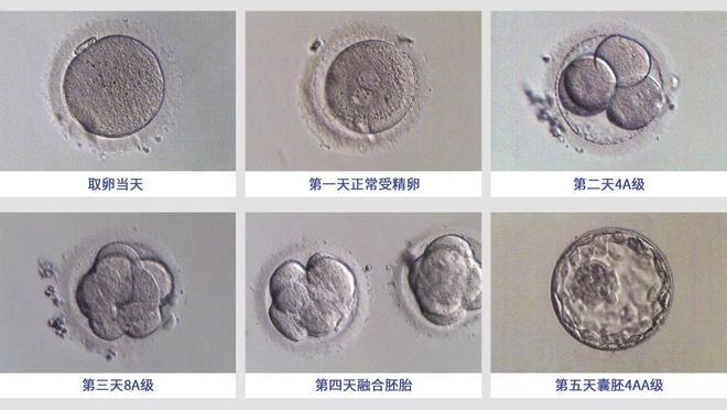 试管婴儿过程中应该培养多少个胚胎才合适？