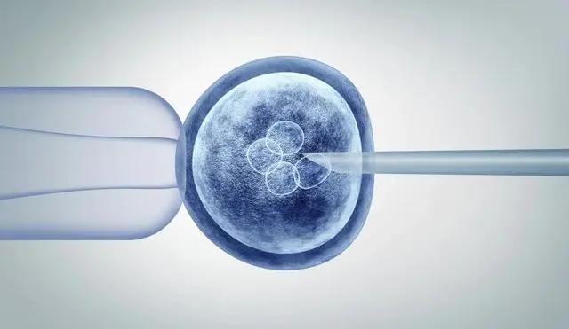  IVF-ET