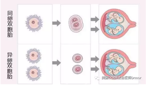 试管婴儿、双胞胎几率、生殖医疗