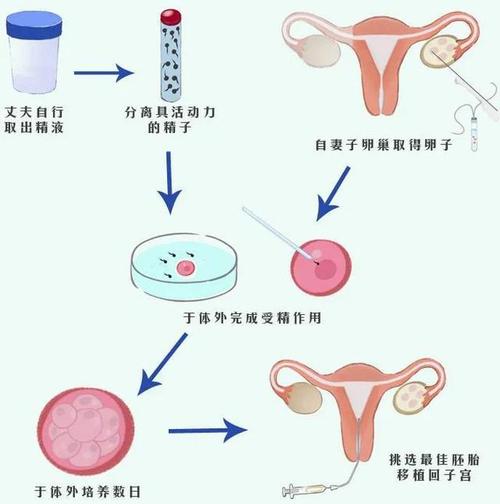 试管婴儿生育过程：为何更容易实现着床成功？