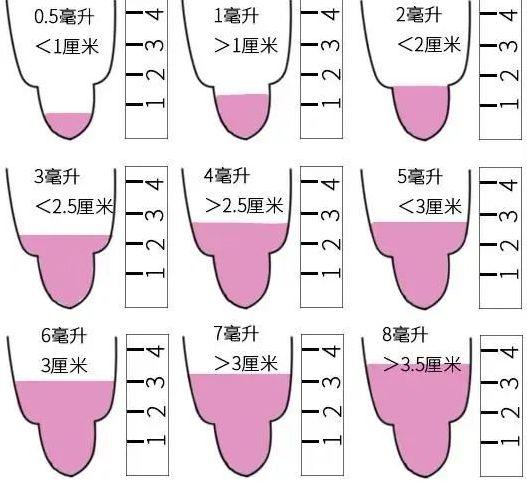 卵子精子质量