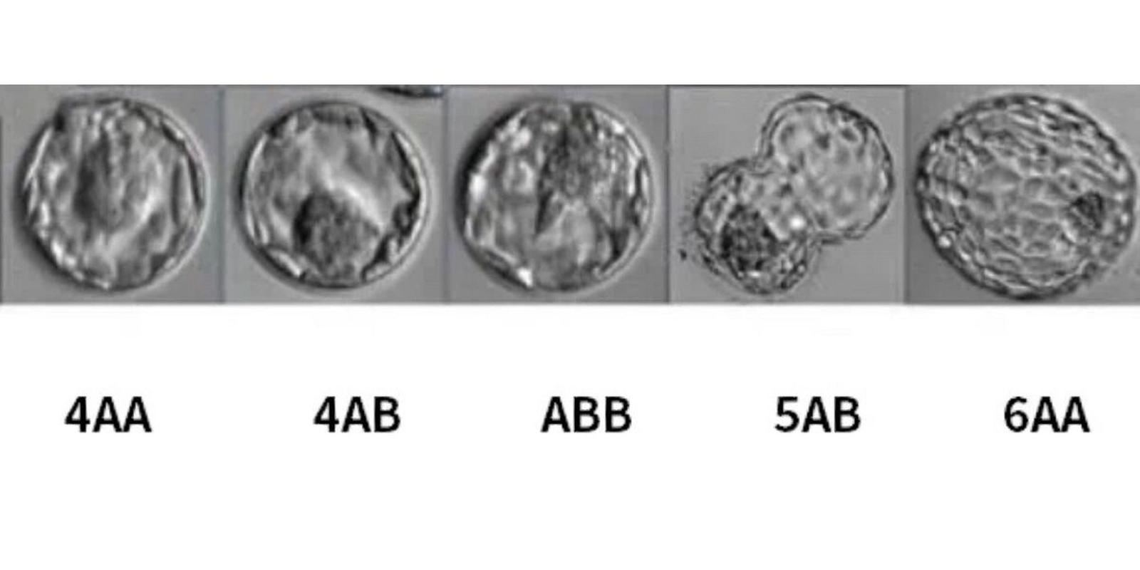 4AB 胚胎