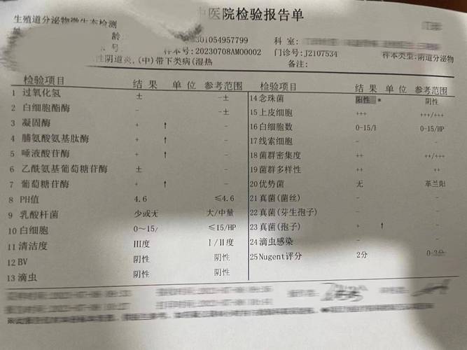 妇科检查报告