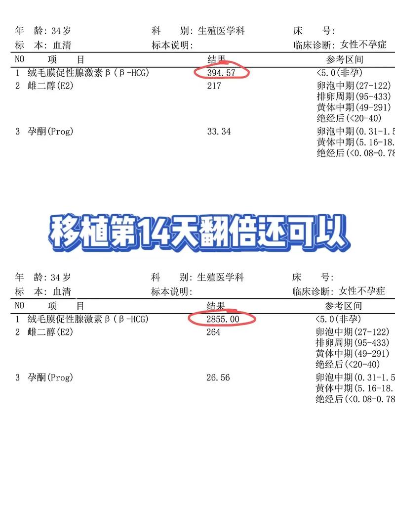 HCG 数值