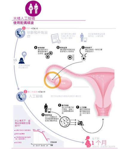 辅助生殖技术规定