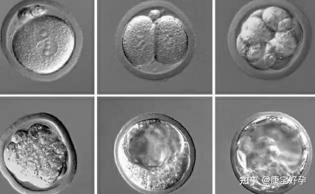 试管婴儿、冻囊胚移植、生殖医疗