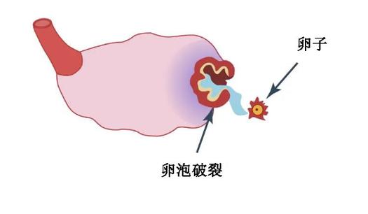 卵泡缺失