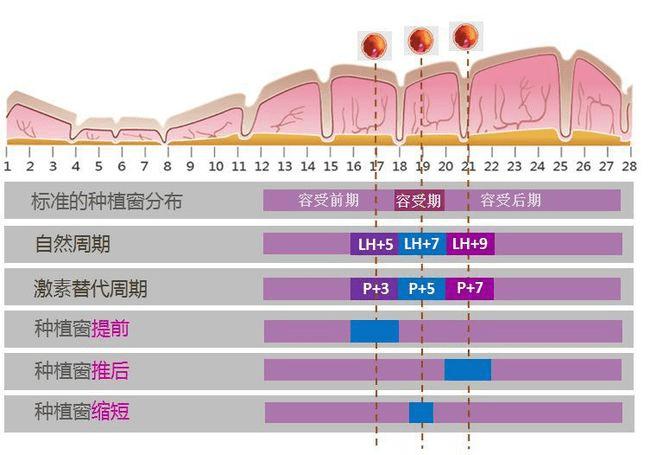 如何选择最佳试管婴儿移植时机与数量？