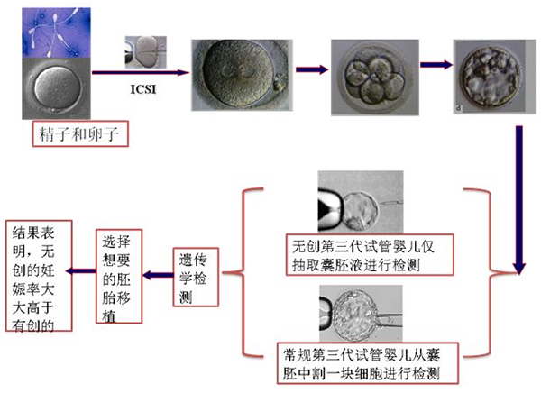 试管婴儿三代技术是否会带来更多健康风险？