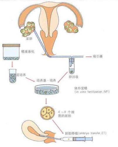 女性试管婴儿、二代试管婴儿、生殖医学