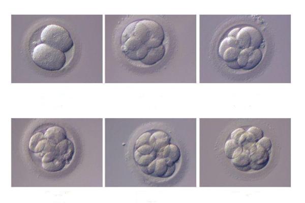 试管婴儿胚胎发育几分最佳？专家为您解析