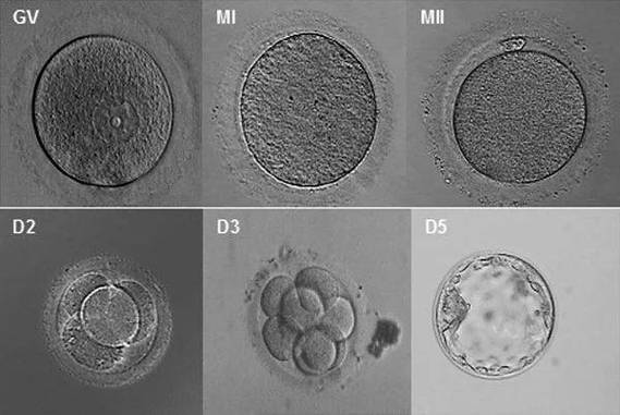 二代试管婴儿、试管婴儿第三阶段、胚胎培养、胚胎评估、胚胎移植