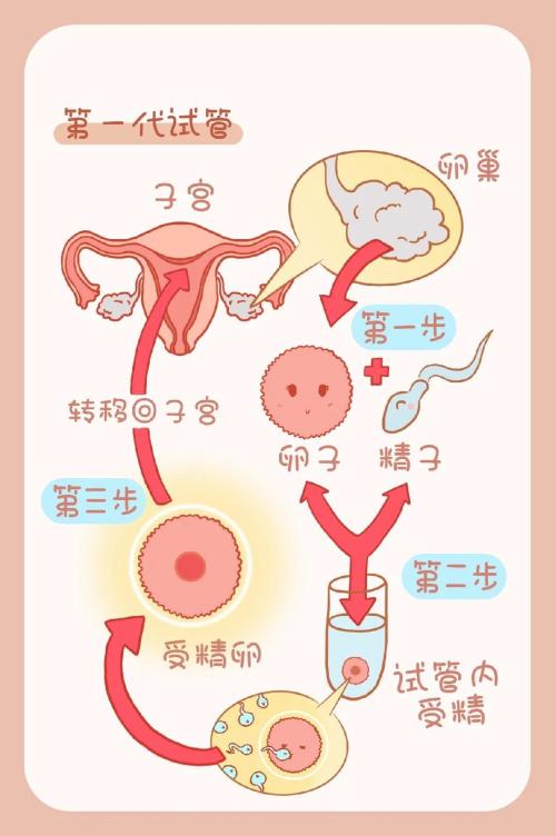 试管婴儿过程：几个月后可以实现怀孕？