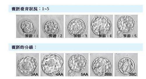 囊胚分级