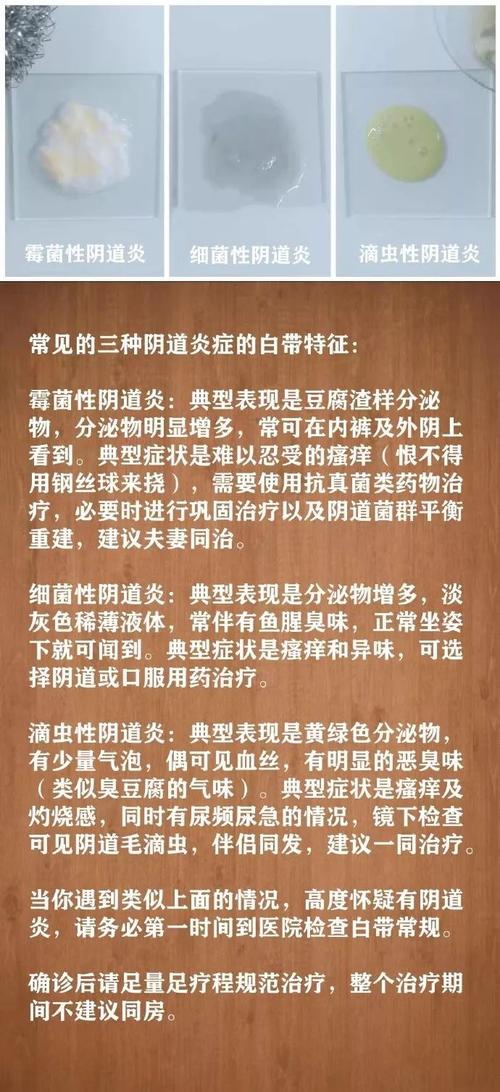 细菌性阴道炎症