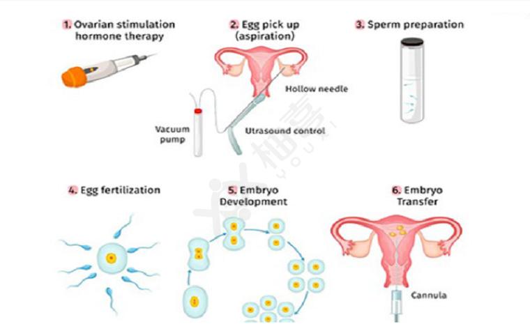 试管婴儿、双胞胎、促排卵治疗、胚胎移植、胚胎筛选技术