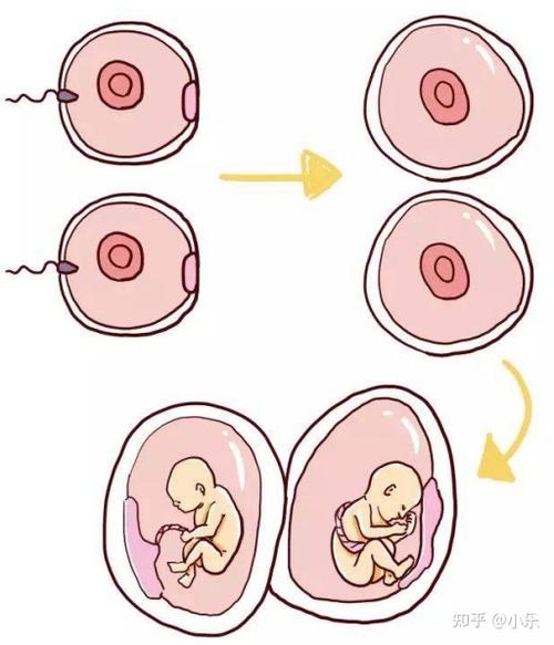 试管婴儿技术：双胞胎出生比例究竟有多高？