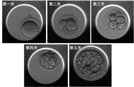 精子卵子质量