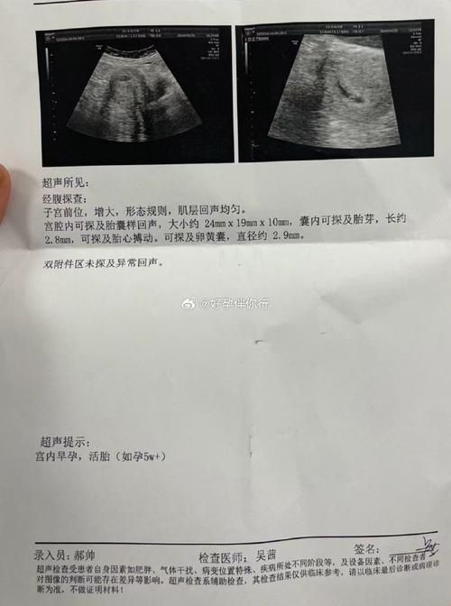 试管婴儿流产是否可以算作怀孕？深度解析