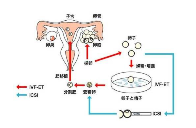 试管婴儿过程：卵泡一般需要长多大才能成功受孕?