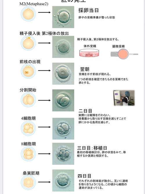 次月移植