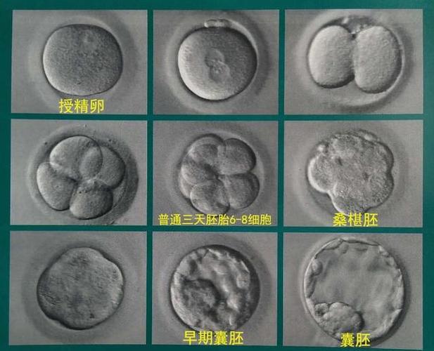 试管婴儿的胚胎能存多久？专家为您解答