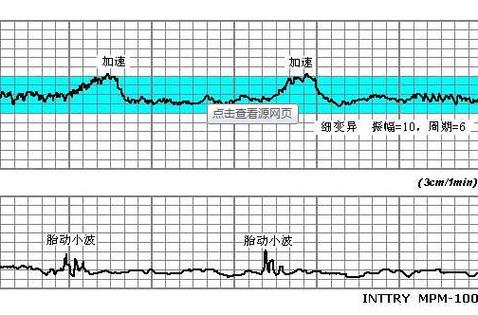 胎心跳动