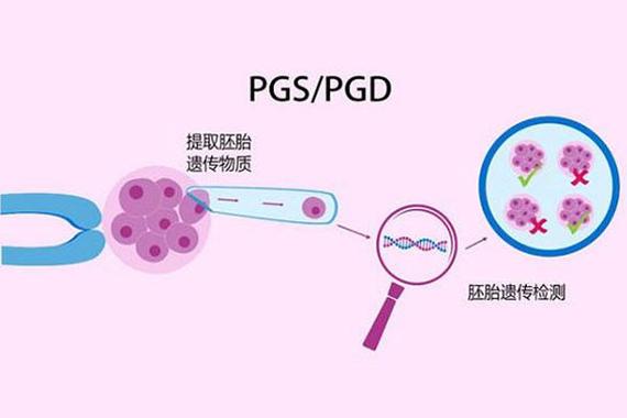 三代试管婴儿芯片费用解析：真的贵吗？