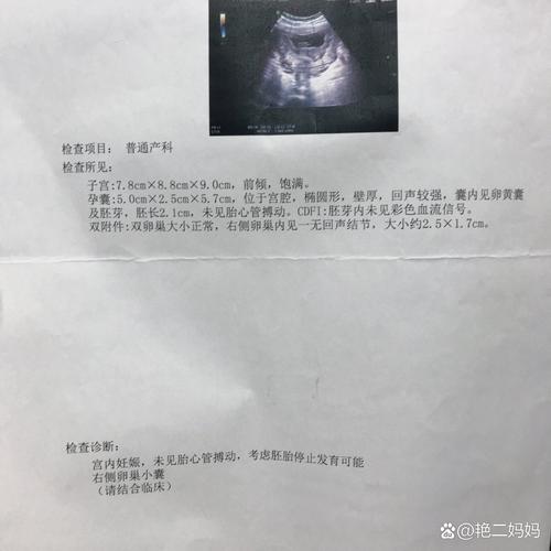 试管婴儿移植后为何频繁反胃恶心？探讨原因与应对措施