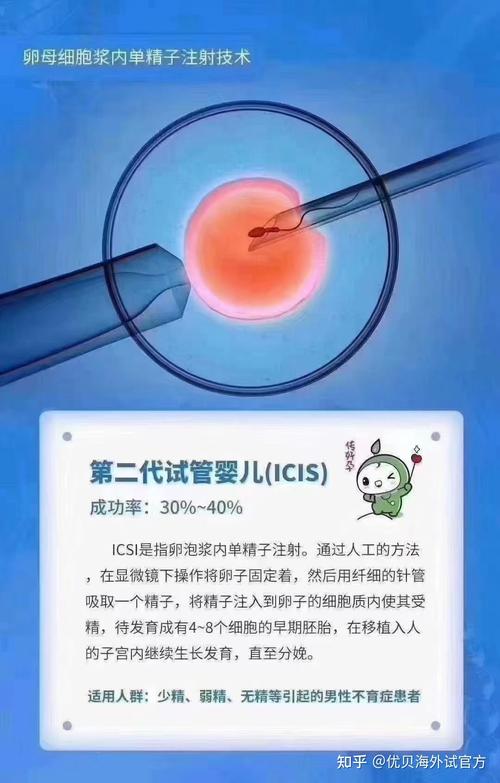 试管婴儿第二代技术究竟有什么不足之处？