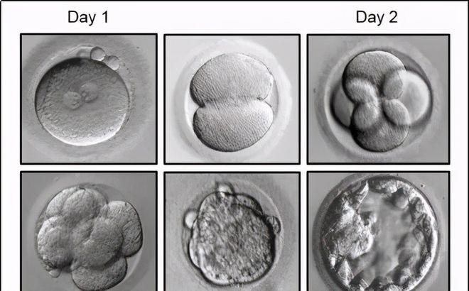 试管婴儿、胚胎大小、胚胎发展阶段、生殖医疗