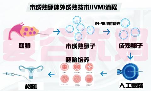 IVM试管技术