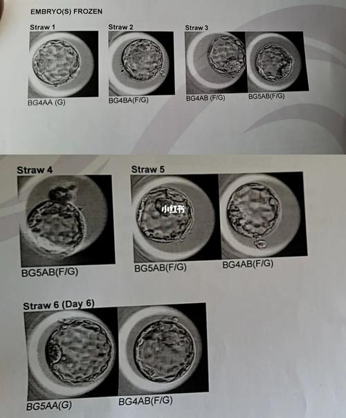 试管婴儿技术：是否可以选择生产四胎？