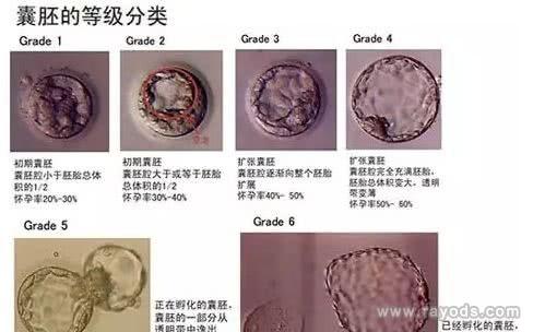 如何判断试管婴儿胚胎的优劣？详细解析及建议