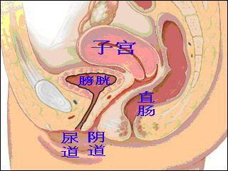 生殖器官评估